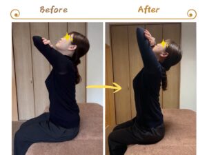 【施術例紹介 : 首・肩こり】